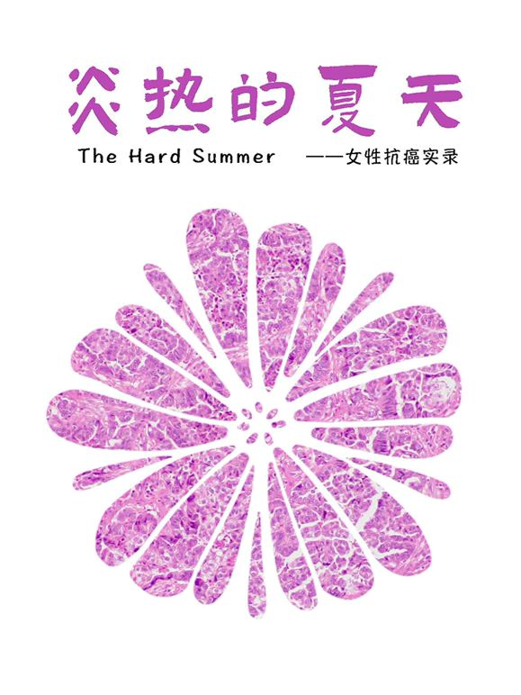 炎热的夏天封面图